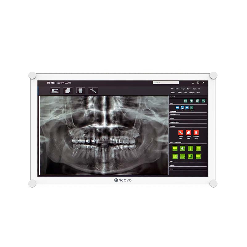 Neovo 21.5" DR-2202 Dental Monitor | 1